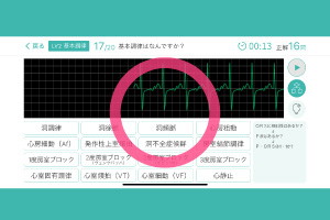 心電図マスターアプリ